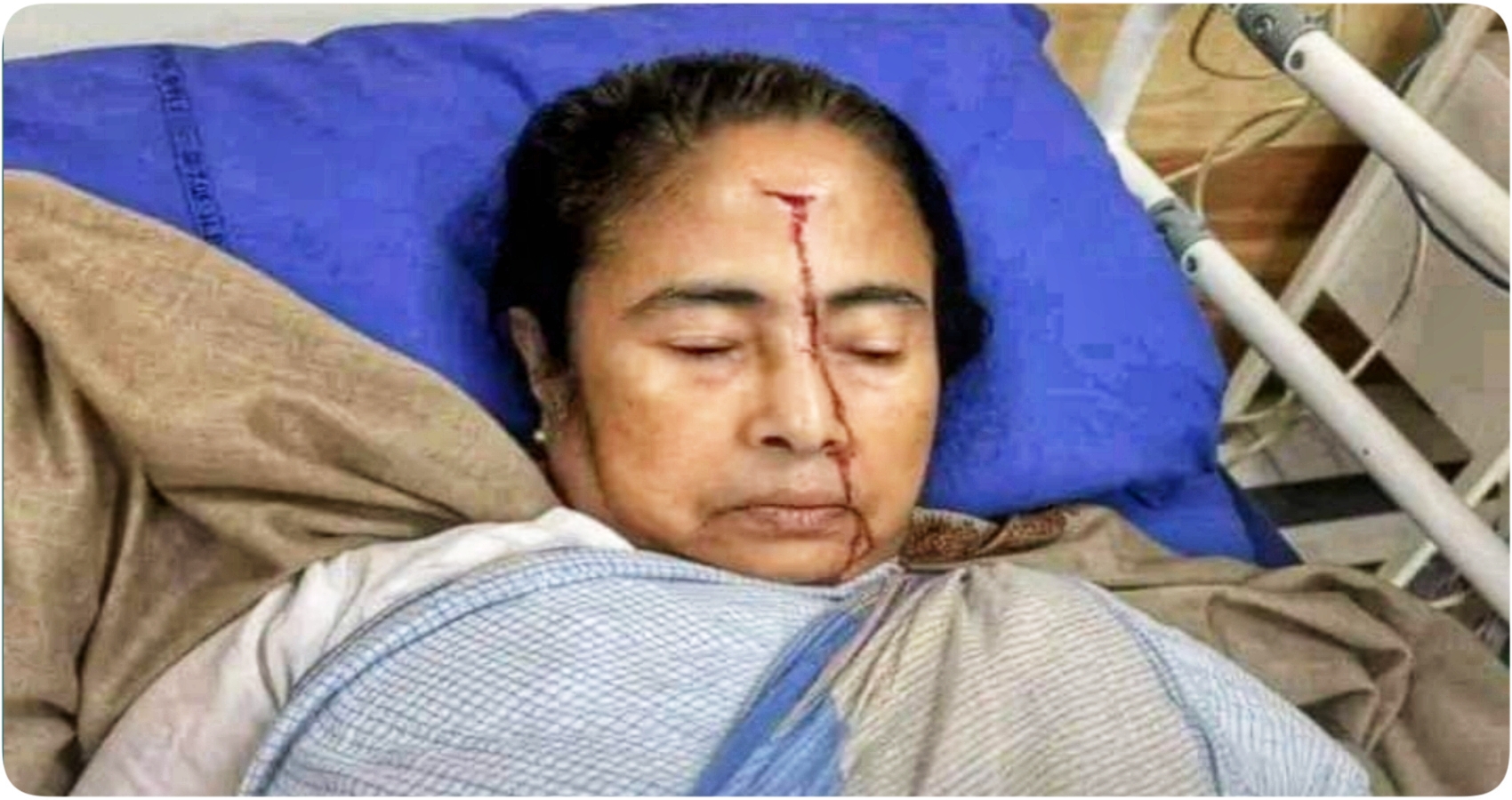 Mamata Banerjee Health Update