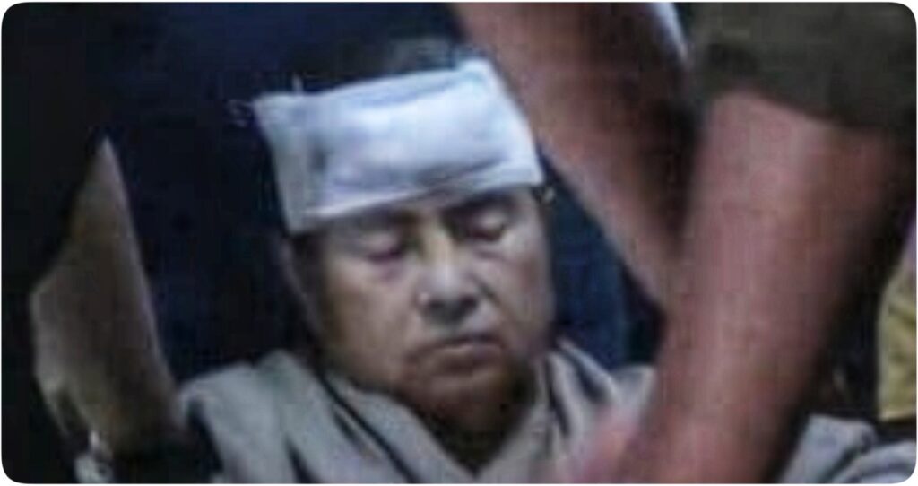 Mamata Banerjee Injured